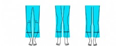 腿型图 O型腿 X型腿OX型腿